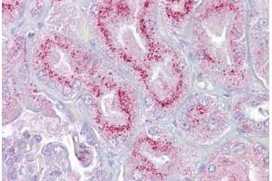 Anti-P2RX2 / P2X2 antibody IHC staining of human kidney.