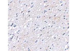 Immunohistochemical staining of human brain tissue using BAIAP3 polyclonal antibody  at 2. (BAIAP3 anticorps  (N-Term))