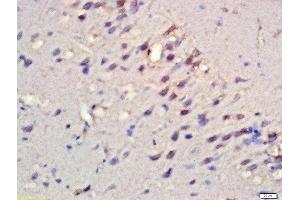 Formalin-fixed and paraffin embedded rat brain labeled with Rabbit Anti-RPS6KB1(Ser427) Polyclonal Antibody, Unconjugated  at 1:200 followed by conjugation to the secondary antibody and DAB staining (RPS6KB1 anticorps  (pSer427))