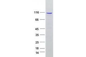 Validation with Western Blot