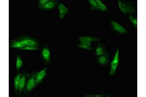Immunofluorescent analysis of Hela cells using ABIN7160373 at dilution of 1:100 and Alexa Fluor 488-congugated AffiniPure Goat Anti-Rabbit IgG(H+L)