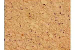 Immunohistochemistry of paraffin-embedded human brain tissue using  at dilution of 1:100 (PTHLH anticorps  (AA 37-175))