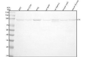 Western blot analysis of DTL using anti-DTL antibody (ABIN7604404).