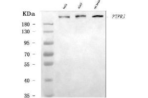 Western blot analysis of DEP1/PTPRJ using anti-DEP1/PTPRJ antibody (ABIN7600061).