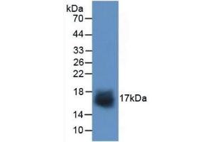 Detection of Recombinant SNCa, Human using Polyclonal Antibody to Synuclein Alpha (SNCa) (SNCA anticorps  (AA 1-140))
