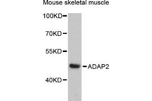 Western blot analysis of extracts of mouse skeletal muscle, using  antibody (ABIN6131170, ABIN6136549, ABIN6136551 and ABIN6217841) at 1:3000 dilution. (ADAP2 anticorps  (AA 1-381))