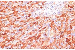 Immunohistochemistry of paraffin-embedded Rat ovary using ASNS Polyclonal Antibody at dilution of 1:100 (40x lens). (Asparagine Synthetase anticorps)