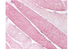 Anti-Neurokinin A Receptor antibody IHC of human skeletal muscle.