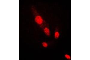 Immunofluorescent analysis of AKT2 staining in HepG2 cells. (AKT2 anticorps  (C-Term))