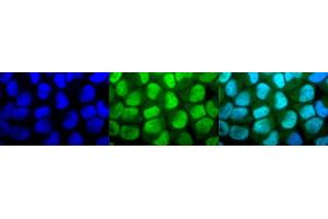Immunocytochemistry/Immunofluorescence analysis using Rabbit Anti-Methylated Lysine Polyclonal Antibody (ABIN5650787). (Lysine (lys) (methylated) anticorps (FITC))