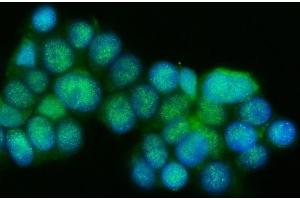 IF analysis of Presenilin 1/PS-1/PSEN1 using anti-Presenilin 1/PS-1/PSEN1 antibody (ABIN7599542). (Presenilin 1 anticorps  (AA 1-76))