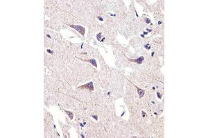 Immunohistochemical analysis of paraffin-embedded H.