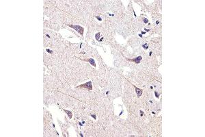 Immunohistochemical analysis of paraffin-embedded H. (FADS2 anticorps  (AA 96-122))