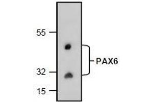 AP26353PU-N: Western blot analysis of PAX6 with rat kidney tissue lysate. (PAX6 anticorps)