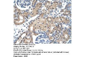 Human kidney (CHRNB2 anticorps  (Middle Region))
