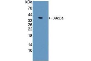 Detection of Recombinant TFF3, Rat using Polyclonal Antibody to Trefoil Factor 3 (TFF3) (TFF3 anticorps  (AA 23-81))