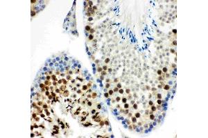 Anti-MCAK antibody, (ABIN3043278), IHC(P)IHC(P): Mouse Testis Tissue