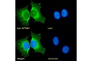 (ABIN184635) Immunofluorescence analysis of paraformaldehyde fixed U2OS cells, permeabilized with 0.