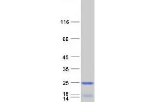 Immature Colon Carcinoma Transcript 1 (ICT1) protein (Myc-DYKDDDDK Tag)