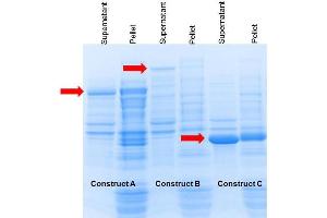 SDS-PAGE of Construct A, B and C plasmids transformed in E. (ProXtract B™ Extraction Buffer)
