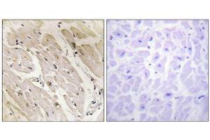 Immunohistochemistry (IHC) image for anti-Protein Kinase, AMP-Activated, gamma 2 Non-Catalytic Subunit (PRKAG2) (N-Term) antibody (ABIN1850045) (PRKAG2 anticorps  (N-Term))