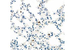 Immunohistochemistry of paraffin embedded rat lung using SIX1 (ABIN7075617) at dilution of 1: 650 (400x lens) (SIX Homeobox 1 anticorps)