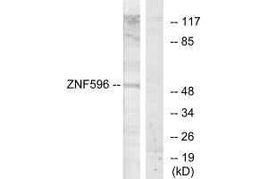 Western blot analysis of extracts from Jurkat cells, using ZNF596 antibody. (ZNF596 anticorps  (Internal Region))
