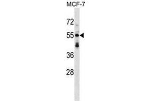 Western blot analysis in MCF-7 cell line lysates (35ug/lane) using Syntrophin-3 / SNTB2 Antibody . (SNTB2 anticorps  (Middle Region))