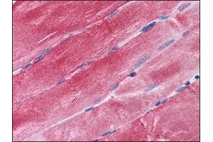 Immunohistochemistry Image: Human Skeletal Muscle: Formalin-Fixed, Paraffin-Embedded (FFPE) (BAG3 anticorps  (C-Term))
