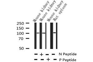 Western blot analysis of Phospho-NF kappaB p105/p50 (Ser932) expression in various lysates
