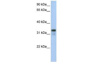 GLYATL2 antibody used at 1 ug/ml to detect target protein. (GLYATL2 anticorps  (Middle Region))