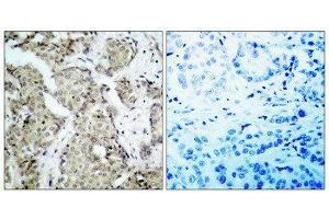 Immunohistochemistry (IHC) image for anti-Mitogen-Activated Protein Kinase Kinase 3 (MAP2K3) (pSer189), (Ser207) antibody (ABIN1847502)