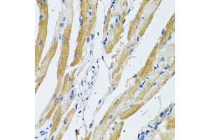 Immunohistochemistry of paraffin-embedded rat heart using GDAP1 antibody (ABIN2562793) at dilution of 1:100 (40x lens). (GDAP1 anticorps)