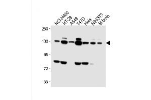 All lanes : Anti-FGFR2 Antibody (C-term) at 1:1000 dilution Lane 1: NCI- whole cell lysate Lane 2: HT-29 whole cell lysate Lane 3: A549 whole cell lysate Lane 4: T47D whole cell lysate Lane 5: Hela whole cell lysate Lane 6: NIH/3T3 whole cell lysate Lane 7: Mouse brain lysate Lysates/proteins at 20 μg per lane.
