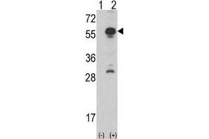 Western Blotting (WB) image for anti-Inhibin, alpha (INHA) antibody (ABIN3002774) (Inhibin alpha anticorps)