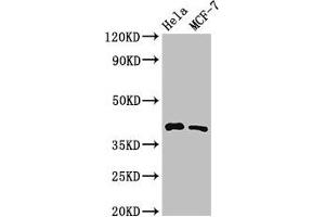 Western Blot Positive WB detected in: Hela whole cell lysate, MCF-7 whole cell lysate All lanes: HLA-B antibody at 3. (HLA-B anticorps  (AA 197-306))