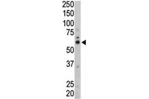 Western blot analysis of FYN antibody and mouse liver tissue lysate.