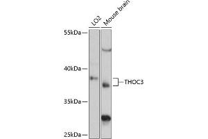 Western blot analysis of extracts of various cell lines, using THOC3 antibody (ABIN6128824, ABIN6149117, ABIN6149118 and ABIN6217153) at 1:3000 dilution. (THO Complex 3 anticorps  (AA 1-200))
