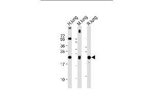 All lanes : Anti-SFTPC Antibody (N-term) at 1:2000 dilution Lane 1: Human lung lysate Lane 2: Mouse lung lysate Lane 3: Rat lung lysate Lysates/proteins at 20 μg per lane.