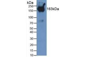 Detection of PZP in Mouse Serum using Polyclonal Antibody to Pregnancy Zone Protein (PZP)