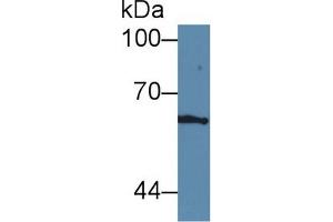 Detection of ICAM1 in Human dog brain cell lysate using Polyclonal Antibody to Intercellular Adhesion Molecule 1 (ICAM1)