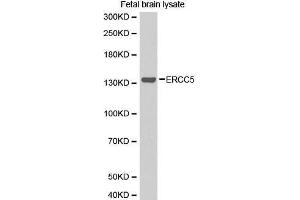 Western Blotting (WB) image for anti-DNA Repair Protein Complementing XP-G Cells (ERCC5) (AA 1-270) antibody (ABIN1512873) (ERCC5 anticorps  (AA 1-270))