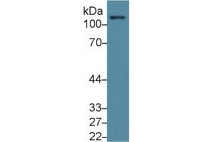 Detection of FAK in Human Jurkat cell lysate using Polyclonal Antibody to Focal Adhesion Kinase (FAK) (FAK anticorps  (AA 798-1041))