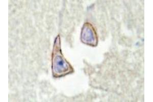 Immunohistochemistry analysis of KSR2 in human brain tissue (Formalin-fixed, Paraffin-embedded) using Kinase suppressor of Ras 2 antibody .