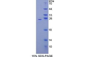 SDS-PAGE analysis of Mouse NFkB2 Protein. (Nuclear Factor kappa B2 Protéine)