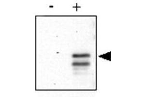Anti-CREB pS133 was used to detect phosphorylated CREB by western blot.