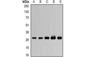 Western blot analysis of RISP expression in SW620 (A), MCF7 (B), mouse heart (C), mouse ovary (D), rat kidney (E) whole cell lysates.