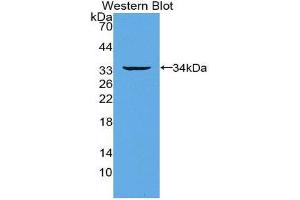 Western Blotting (WB) image for anti-Tumor Necrosis Factor Receptor Superfamily, Member 11a, NFKB Activator (TNFRSF11A) (AA 330-615) antibody (ABIN3205543) (TNFRSF11A anticorps  (AA 330-615))