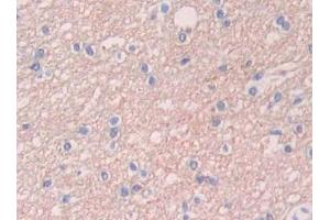 Used in DAB staining on fromalin fixed paraffin- embedded kidney tissue