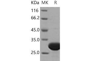 Western Blotting (WB) image for Ubiquitin Carboxyl-terminal Esterase L3 (Ubiquitin Thiolesterase) (Uchl3) (Active) protein (His tag) (ABIN7321219)